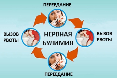Лечение булимии в Сланцах